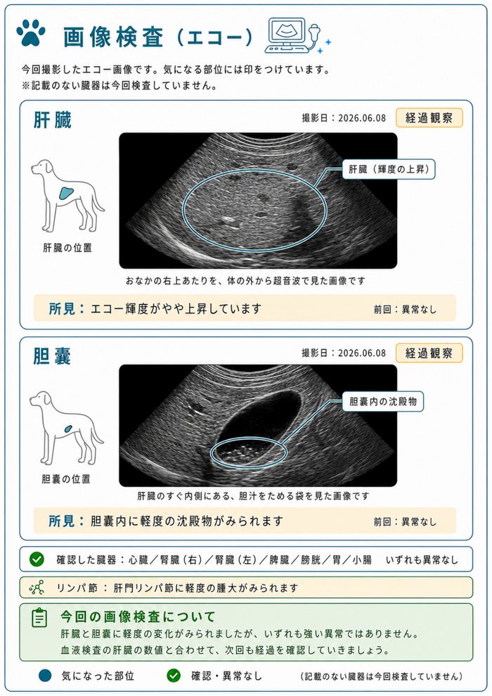 エコー画像イメージ
