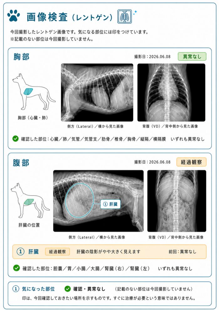 レントゲン画像イメージ